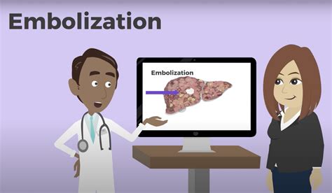 Embolization for Liver Cancer - Canadian Liver Foundation