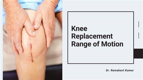 Knee Replacement Range of Motion | Knee Range of Motion Chart