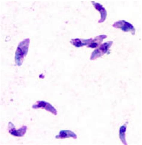 Toxoplasma/Toxoplasmosis | Concise Medical Knowledge