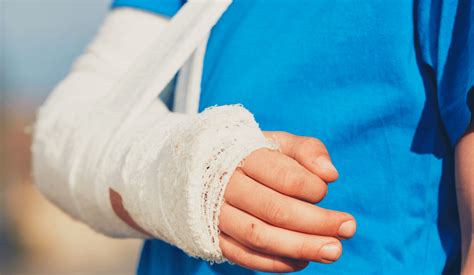 Learn more about the recovery timeline from hand surgery.