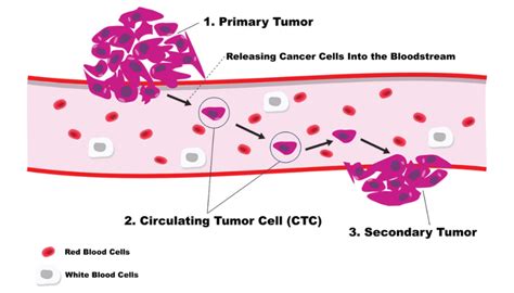 Circulating Tumor Cells Archives - NFCR