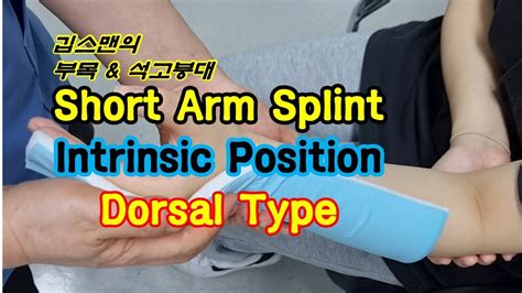 Short Arm Intrinsic Splint Dorsal Type - YouTube