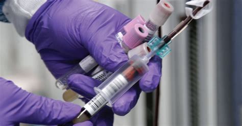 Liquid Biopsies Could be Used as Diagnostic Tool | MesotheliomaHelp.org