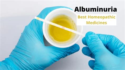 Albuminuria - Causes, Symptoms & Best Homeopathic Medicines