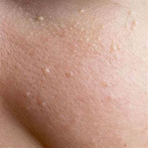 What’s That on Your Face? | Women's Health