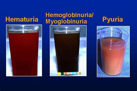 VTA 130 Chapter 3 - Urinalysis Flashcards | Quizlet