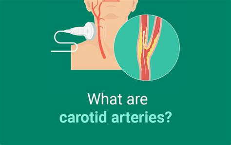 Get The Best Carotid Doppler Test with Best Cost in Kolkata ...