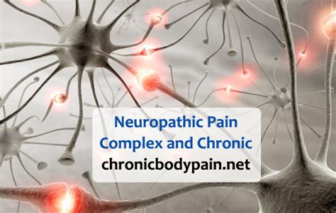 Neuropathic Pain: Complex and Chronic – Chronic Body Pain