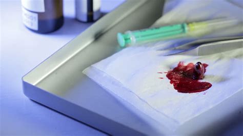 Doctor Removing Bullet Stock Footage Video 3343100 - Shutterstock