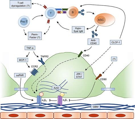 Frontiers | Autoimmunity in Focal Segmental Glomerulosclerosis: A Long-Standing Yet Elusive ...