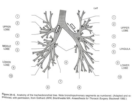 Anatomy of the Tracheobronchial Tree Quiz