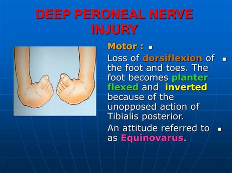 PPT - FEMORAL NERVE INJURY PowerPoint Presentation - ID:472761