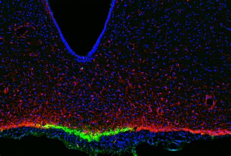 anti-IFN gamma antibody (ARG56607) - arigo Biolaboratories