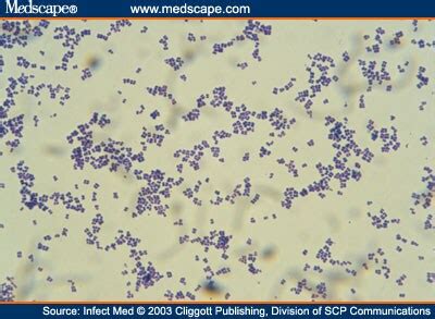 Suspected Endocarditis