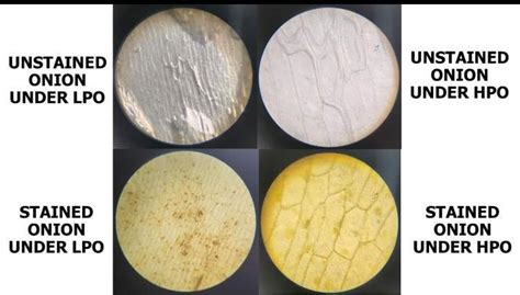 5. Compare the image of the unstained and stained onion skin cell under ...