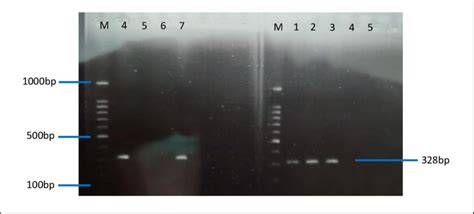 Agarose gel electrophoresis; M is 100 bp marker ladder DNA, Positive... | Download Scientific ...