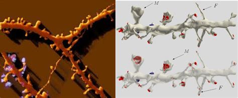 Left: Spines on a dendrite. Right: three-dimensional EM reconstruction ...