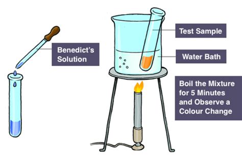 Benedict's Test - Reagent, Composition, Principal and Uses