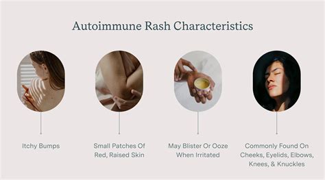 Autoimmune Rash: Causes, Types, Side Effects, and Treatment