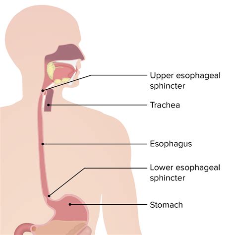 Enfermedad por Reflujo Gastroesofágico (ERGE) | Concise Medical Knowledge