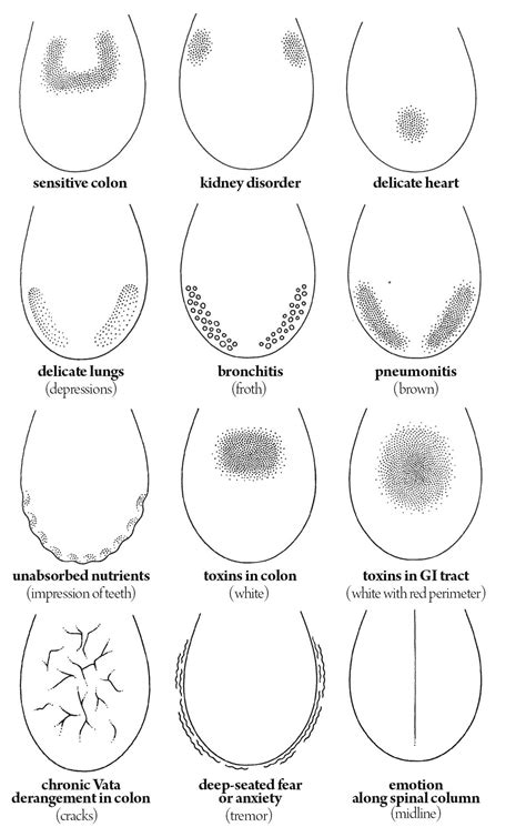 Ayurvedic Tongue Diagnosis Chart: A Visual Reference of Charts | Chart ...