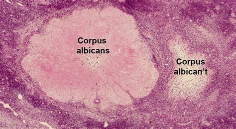 Corpus Albicans Histology