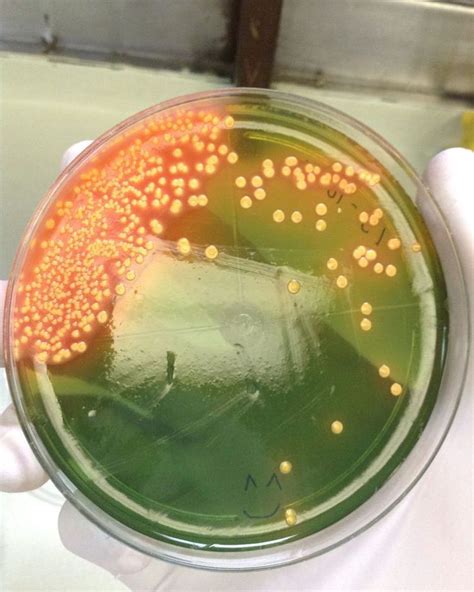 E.coli on Hektoen Enteric Agar | Microbiology, Microbiology lab, Petri ...