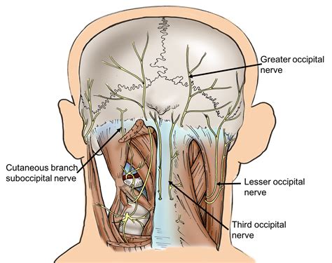 Cureus | A Case Report of an Enlarged Suboccipital Nerve with Cutaneous Branch