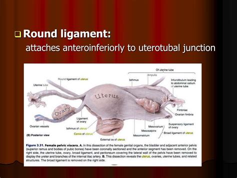 PPT - Genital prolapse PowerPoint Presentation - ID:737997