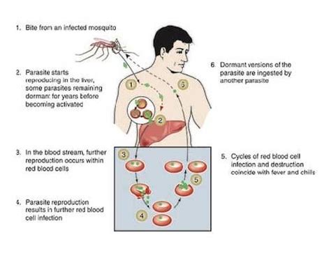 Malaria: Symptoms, Complications, and Treatment