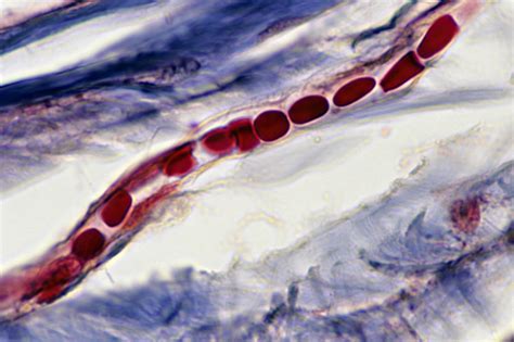 An Illustrated Guide to Capillary Fluid Exchange