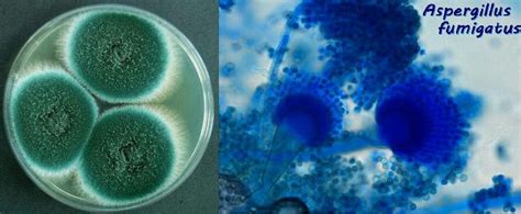 Aspergillus fumigatus