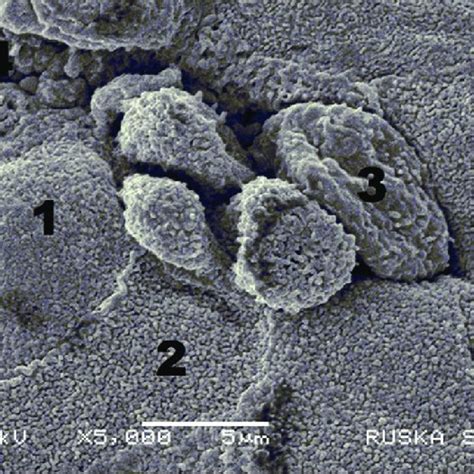 (PDF) Histology and scanning electron microscopy of the tubal tonsil of ...