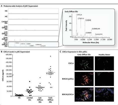 Identification of CXCL4 as the Major Protein Product of Plasmacytoid ...