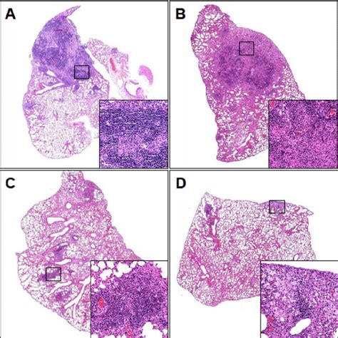 Histological appearance of pulmonary granulomas. Lesions represented by ...