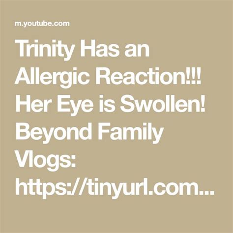 Trinity Has an Allergic Reaction!!! Her Eye is Swollen! Beyond Family ...