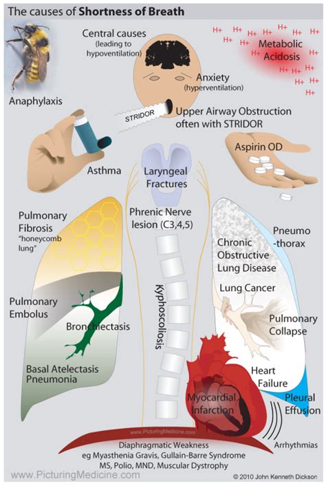 What is Asthma?