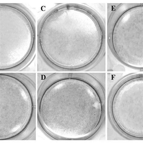 Cell morphology of human dental follicle (HDF) stem cells. HDF1 cells ...