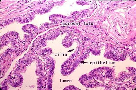 Female Reproductive - Fimbria of uterine tube. | Nurse, It works, Som