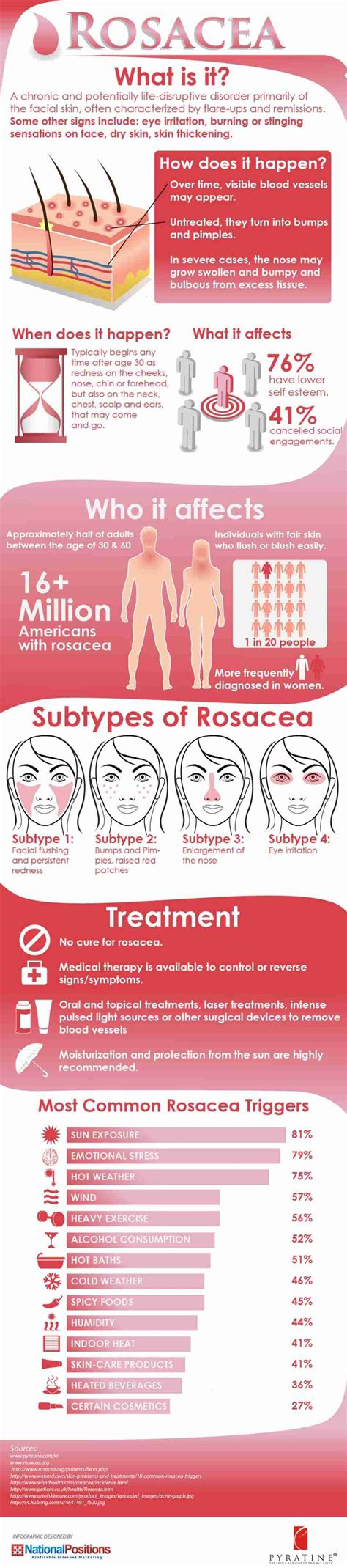 Infographic: What Causes Rosacea?