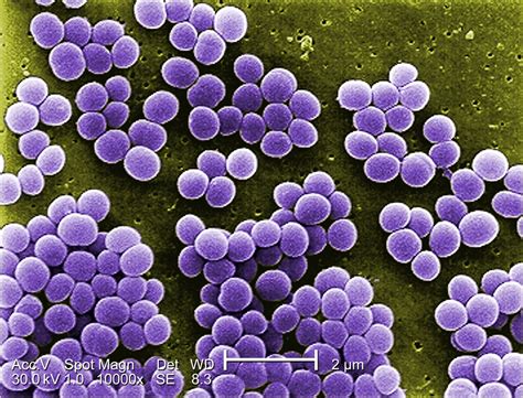 Staphylococcus Epidermidis Infections