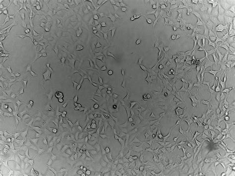 Monitoring HEK293 cell culture inside an incubator - ioLight