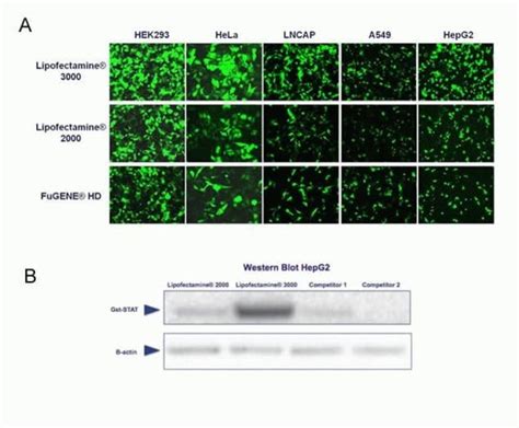 Lipofectamine™ 3000 Transfection Reagent