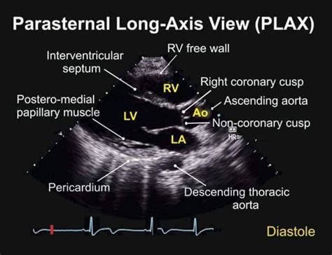 Pin on Cardiac surgery