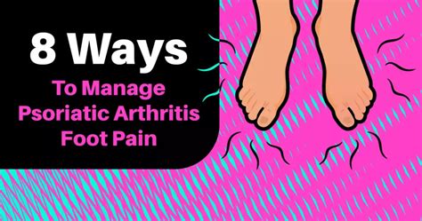 8 Ways To Manage Psoriatic Arthritis Foot Pain | MyPsoriasisTeam