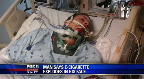 Think E-Cigarettes Are Safe? This Guy Did Too, Until His Vape Exploded