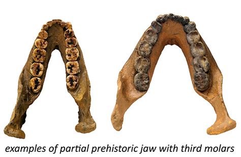 The Myth Behind Wisdom Teeth