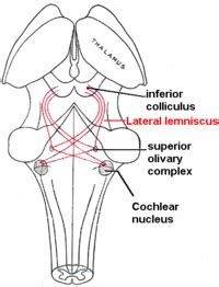 Lateral lemniscus in red, as it connects the cochlear nucleus ... | DPT ...