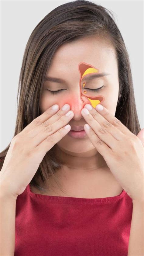 7 Ways To Relieve Nasal Congestion This Monsoon