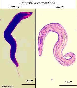 Enterobius vermicularis